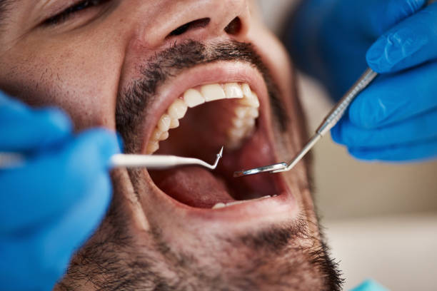 Best Emergency Treatment for Dental Infections or Abscesses in Cherry Hill Mall, NJ